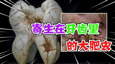 嘴巴生虫|牙齿里的驻虫为什么不会被憋死？